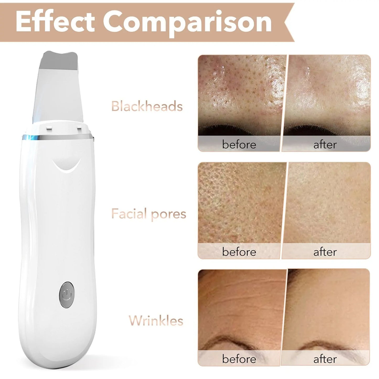 Ultrasonic Skin Scrubber - Rora's Beauty